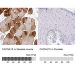 CaV1.1 Antibody