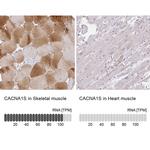 CaV1.1 Antibody