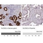 SLC5A5 Antibody