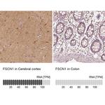 Fascin Antibody