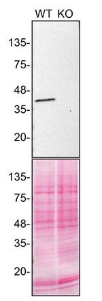 Calponin 3 Antibody