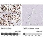 EWSR1 Antibody