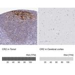 CD21 Antibody