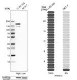 PTPN14 Antibody