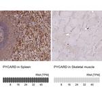 PYCARD Antibody