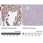 NDUFS2 Antibody