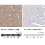 PACSIN1 Antibody