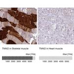 TNNI2 Antibody