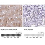 RyR1 Antibody