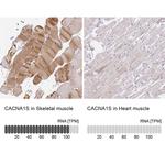 CaV1.1 Antibody