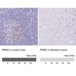 RRM2 Antibody