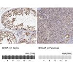 BRCA1 Antibody