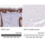 Cytokeratin 5 Antibody