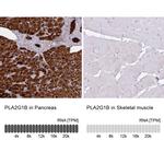 PLA2 Antibody