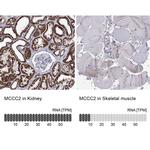 MCCC2 Antibody