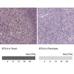 BTLA Antibody