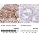 SMYD1 Antibody