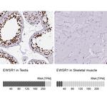 EWSR1 Antibody