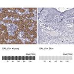 GALM Antibody