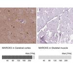 MARCKS Antibody