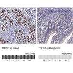 TRPS1 Antibody