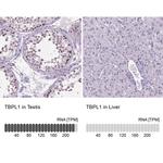 TBPL1 Antibody