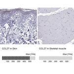 CCL27 Antibody