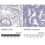 MAGEB2 Antibody