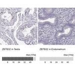 TZFP Antibody