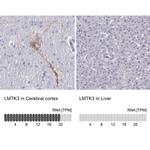 LMTK3 Antibody