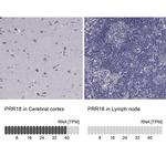 PRR18 Antibody