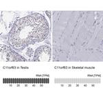 C11orf63 Antibody