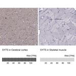 Synaptotagmin 5 Antibody