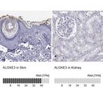 ALOXE3 Antibody