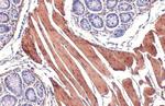 Alpha-Smooth Muscle Actin Antibody in Immunohistochemistry (Paraffin) (IHC (P))