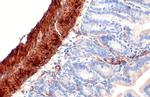 Alpha-Smooth Muscle Actin Antibody in Immunohistochemistry (Paraffin) (IHC (P))