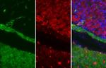 Alpha-Smooth Muscle Actin Antibody in Immunohistochemistry (Paraffin) (IHC (P))