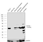 Alpha-Smooth Muscle Actin Antibody