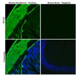 Alpha-Smooth Muscle Actin Antibody