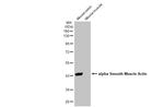 Alpha-Smooth Muscle Actin Antibody in Western Blot (WB)
