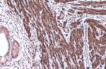 Alpha-Smooth Muscle Actin Antibody in Immunohistochemistry (Paraffin) (IHC (P))