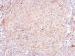 PSA Antibody in Immunohistochemistry (Paraffin) (IHC (P))