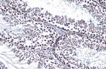 Androgen Receptor Antibody in Immunohistochemistry (Paraffin) (IHC (P))