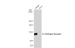 Androgen Receptor Antibody in Western Blot (WB)