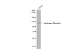 Androgen Receptor Antibody in Western Blot (WB)