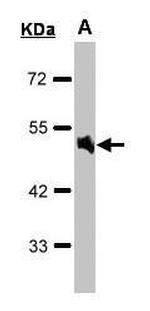 alpha-1a Adrenergic Receptor Antibody in Western Blot (WB)