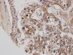 Cannabinoid Receptor 1 Antibody in Immunohistochemistry (Paraffin) (IHC (P))