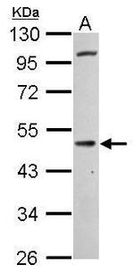 Cannabinoid Receptor 1 Antibody in Western Blot (WB)