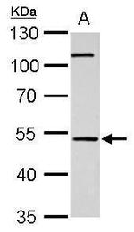 Cannabinoid Receptor 1 Antibody in Western Blot (WB)