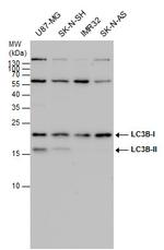 LC3B Antibody in Western Blot (WB)